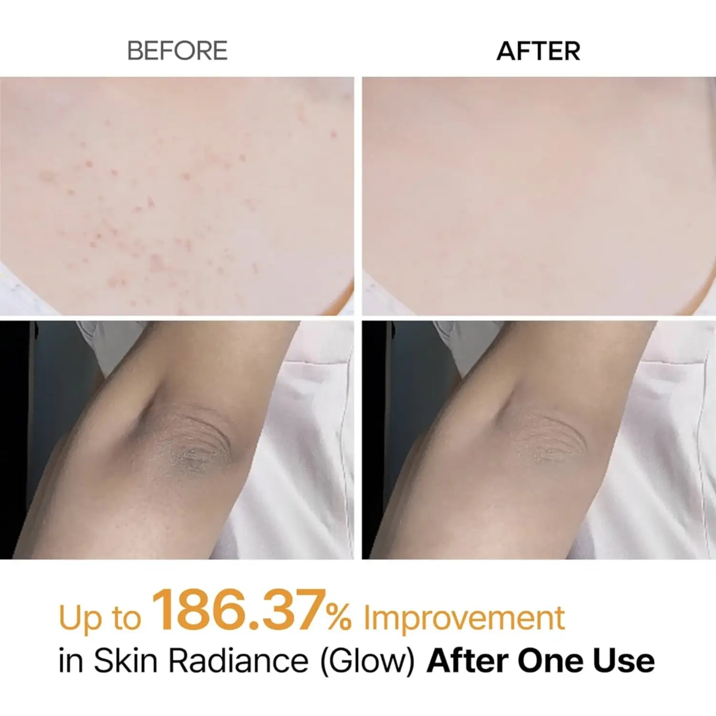 Dr. Melvex Peel Shot Body Spray – Kojic Acid + Turmeric