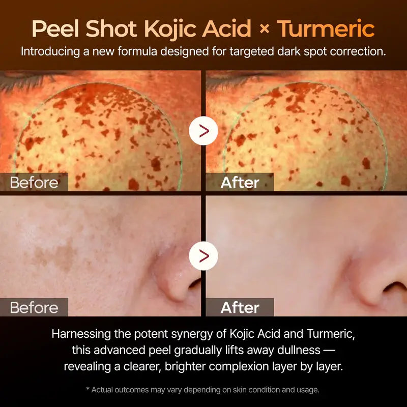 Dr. Melvex Peel Shot Body Spray – Kojic Acid + Turmeric