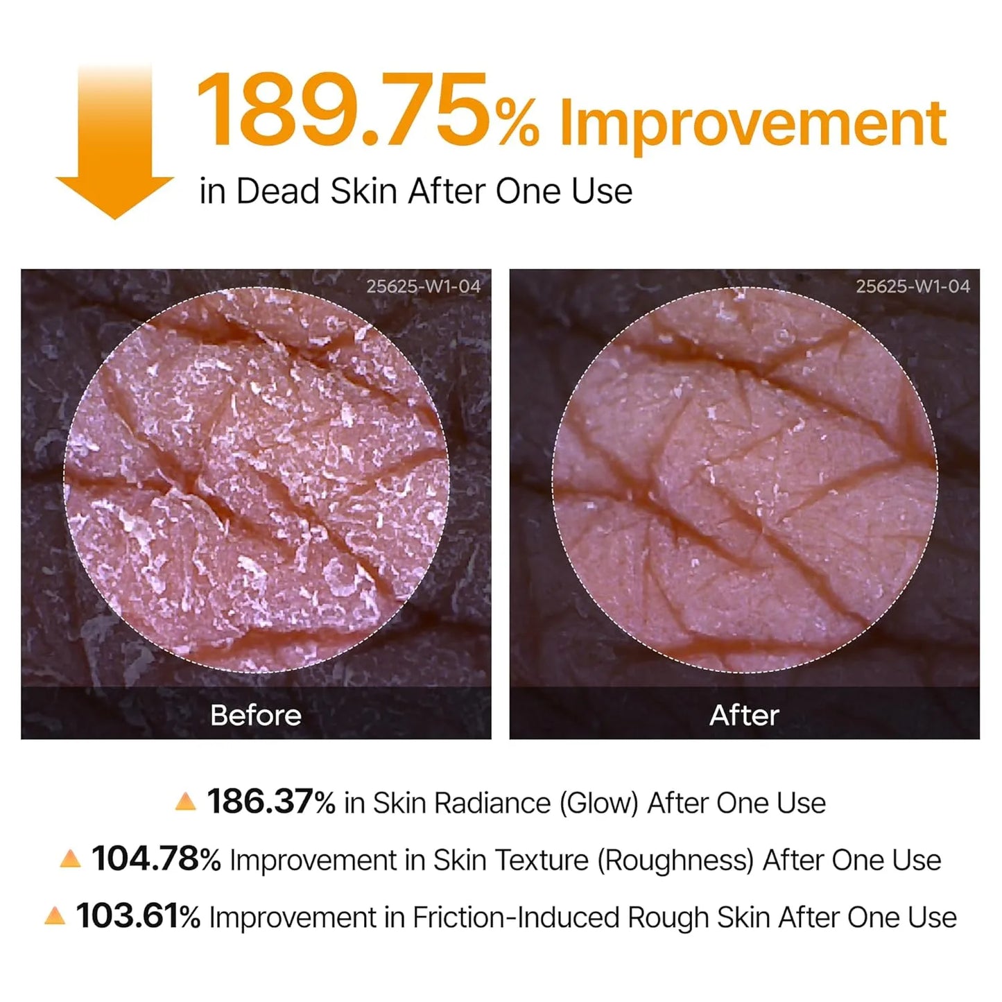 Dr. Melvex Peel Shot Body Spray – Kojic Acid + Turmeric